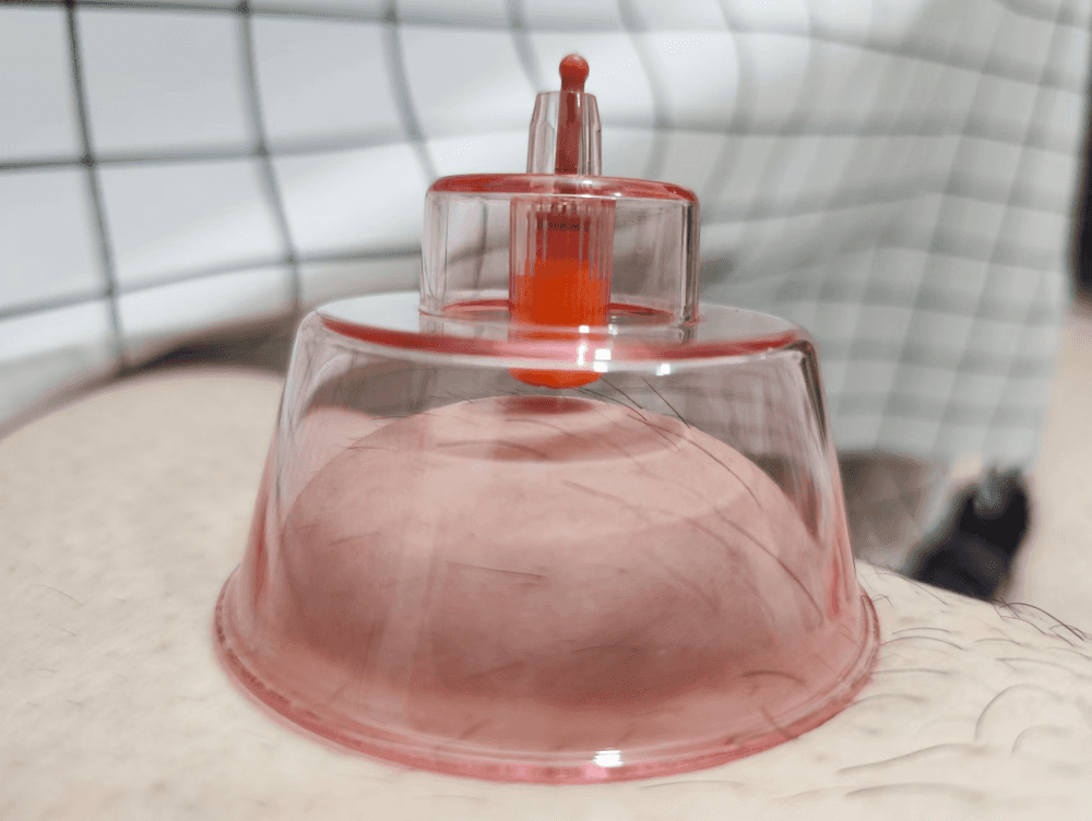 盛夏疗养好伴侣,左点智能走罐器轻体验