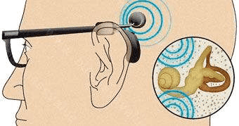 骨传导耳机保护听力吗?骨传导耳机能够降低听力损伤