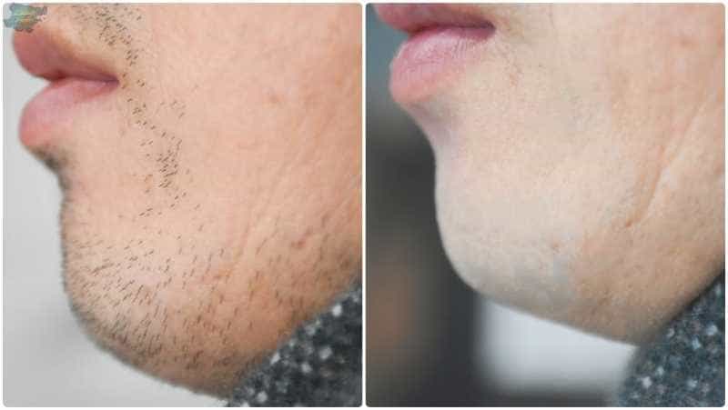 随时随地的剃须享受——奔腾SMART系列合金剃须刀体验