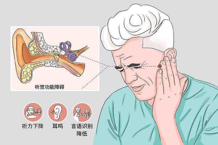 骨传导耳机是利用什么原理听歌?有哪些骨传导耳机入手